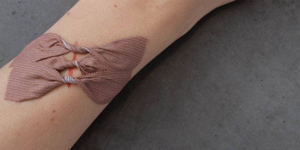 Guide d'utilisation des bandages papillon